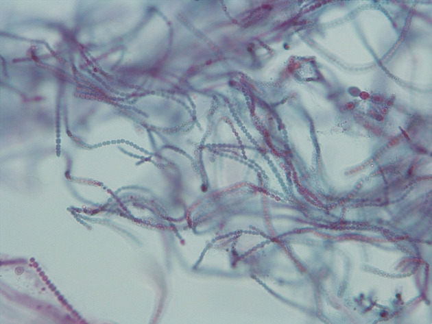 Anabaena Slides - Anabaena 10 400X
